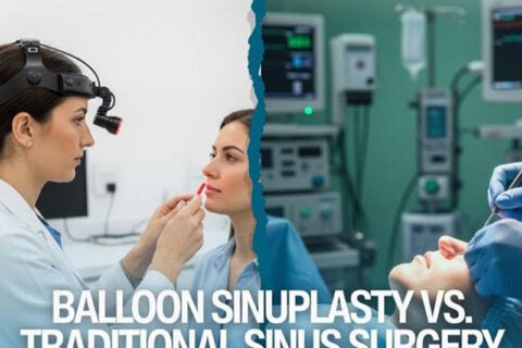 Balloon Sinuplasty vs sinus surgery